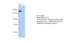 Gamma-Glutamyltransferase 7 Rabbit anti-Human, Polyclonal, Novus Biologicals